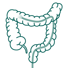 Gms Icon Colonoscopy